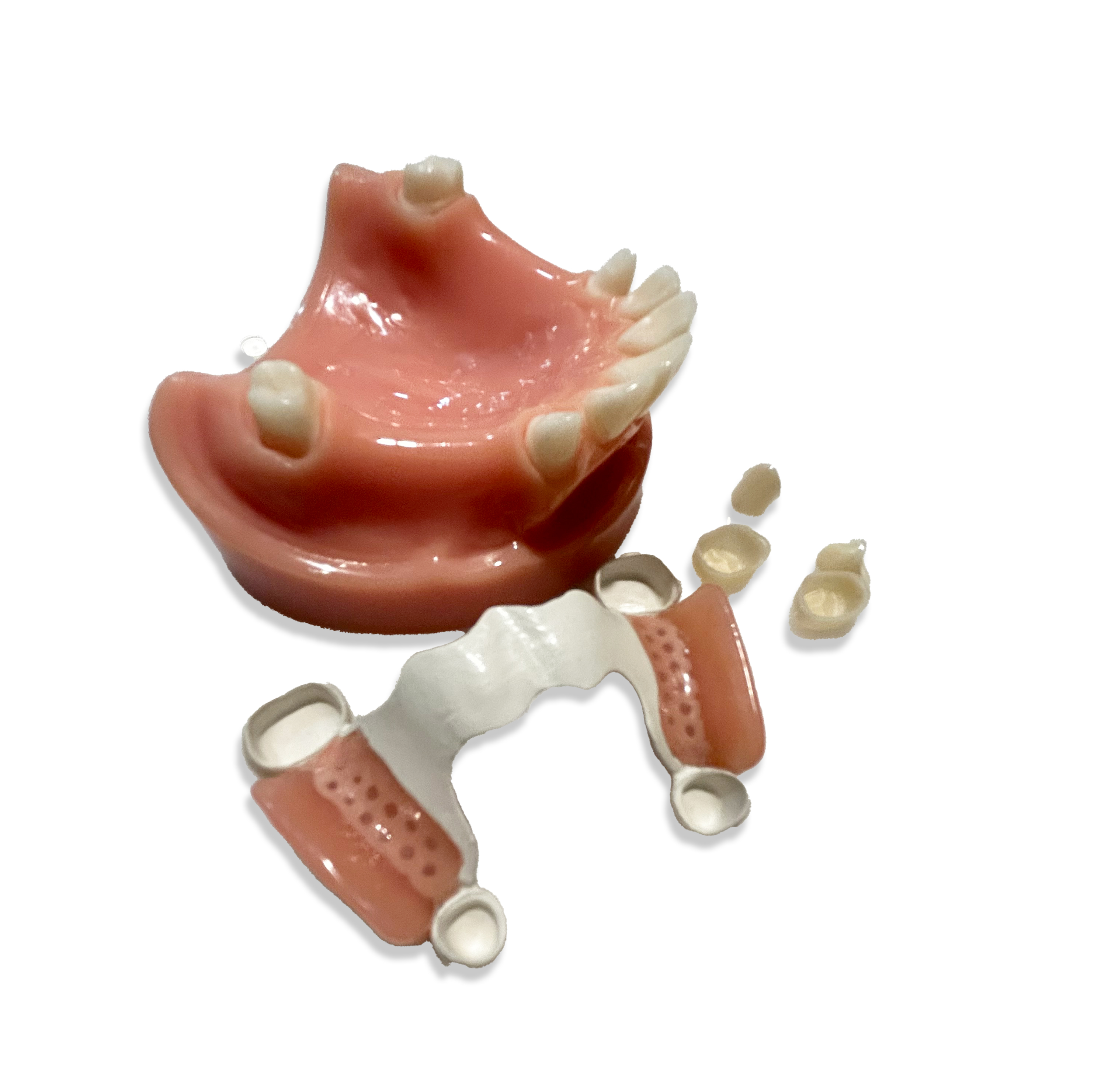 Protiform Teleskopprothese 