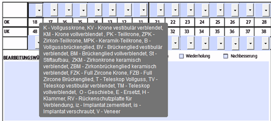 Schritt 2
