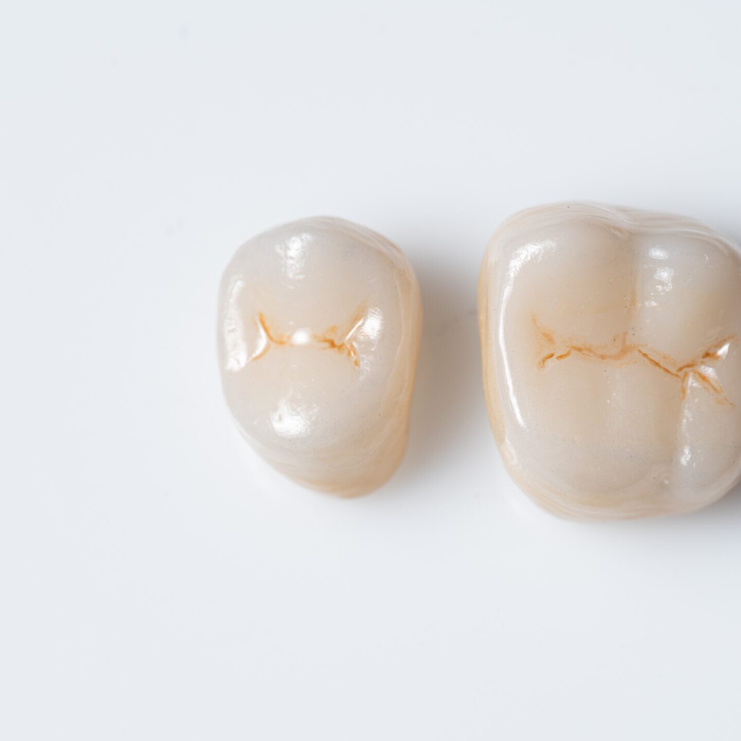 Outside,Of,Dental,Crown,Beautiful,Tooth,Structure