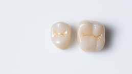 Outside,Of,Dental,Crown,Beautiful,Tooth,Structure