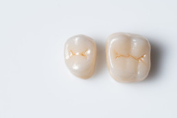 Outside,Of,Dental,Crown,Beautiful,Tooth,Structure