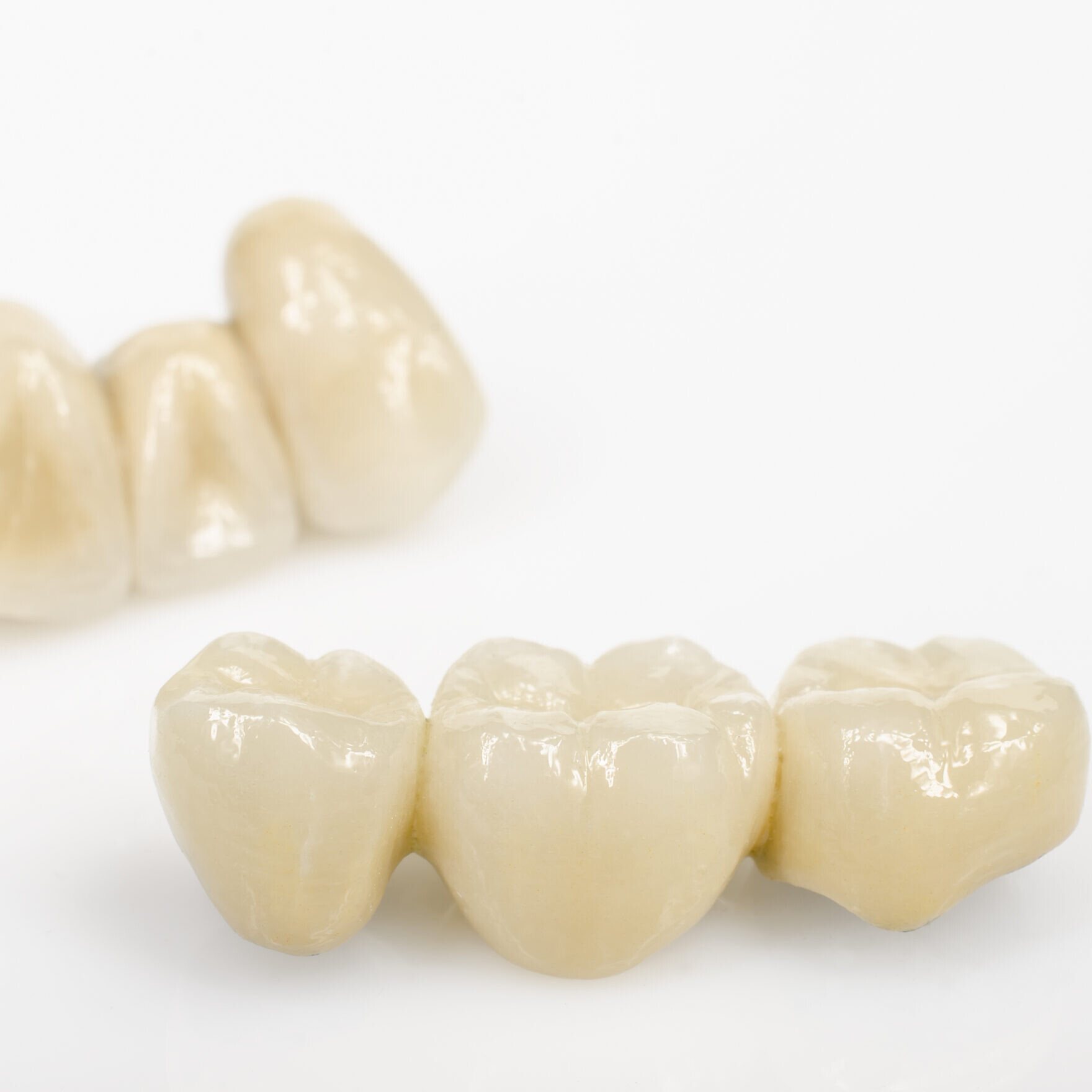 Dental,Bridges,,Ceramics