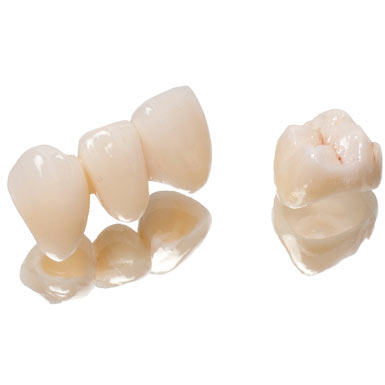Couronne-céramique-sur-zirconium